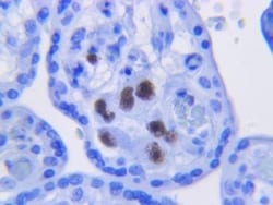 Cytomegalovirus Antibody (DDG9 and CCH2), Novus Biologicals 0.5mL; Unlabeled:Antibodies,